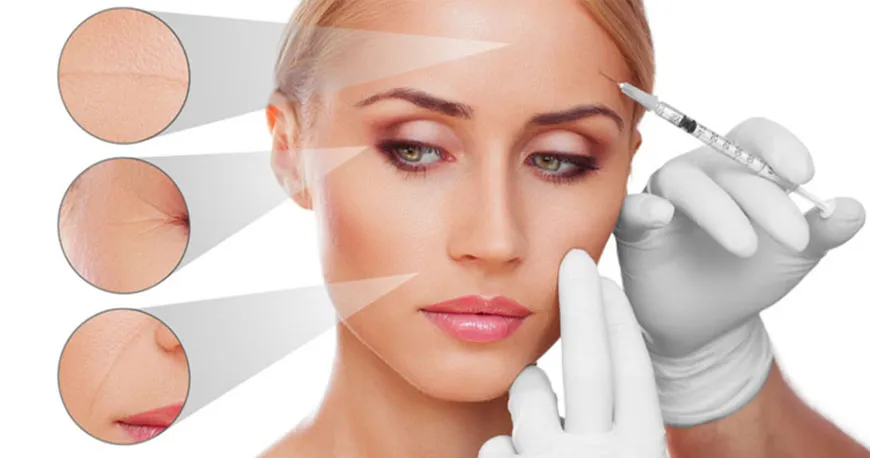 Tratamiento de Ácido Hialurónico en Bienestar Dental Providencia