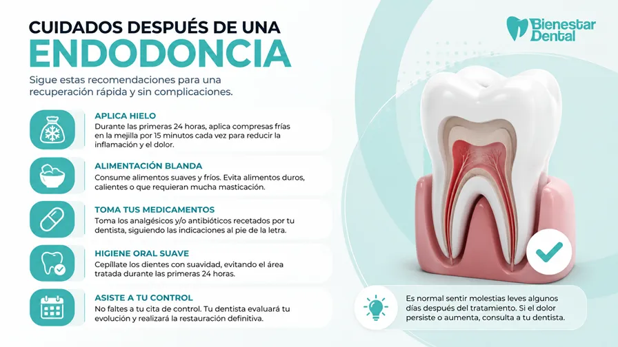 Guía visual de cuidados post-endodoncia con indicaciones de alimentación, medicación e higiene dental después del tratamiento de conducto