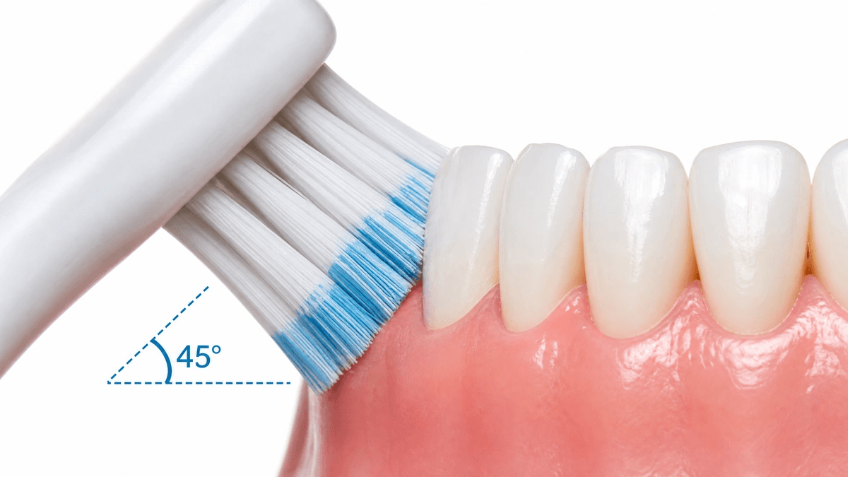 Cepillo de dientes posicionado en ángulo de 45 grados sobre la línea de la encía