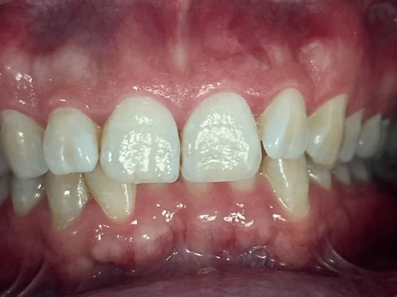 Resultado antes del tratamiento dental en Bienestar Dental - Antes