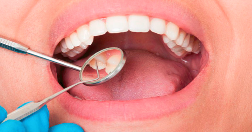 Rehabilitación oral